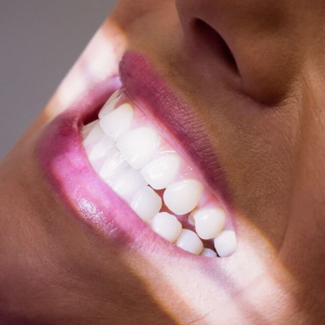 Sourire éclatant à l'institut Le Secret Beauté à Monteux